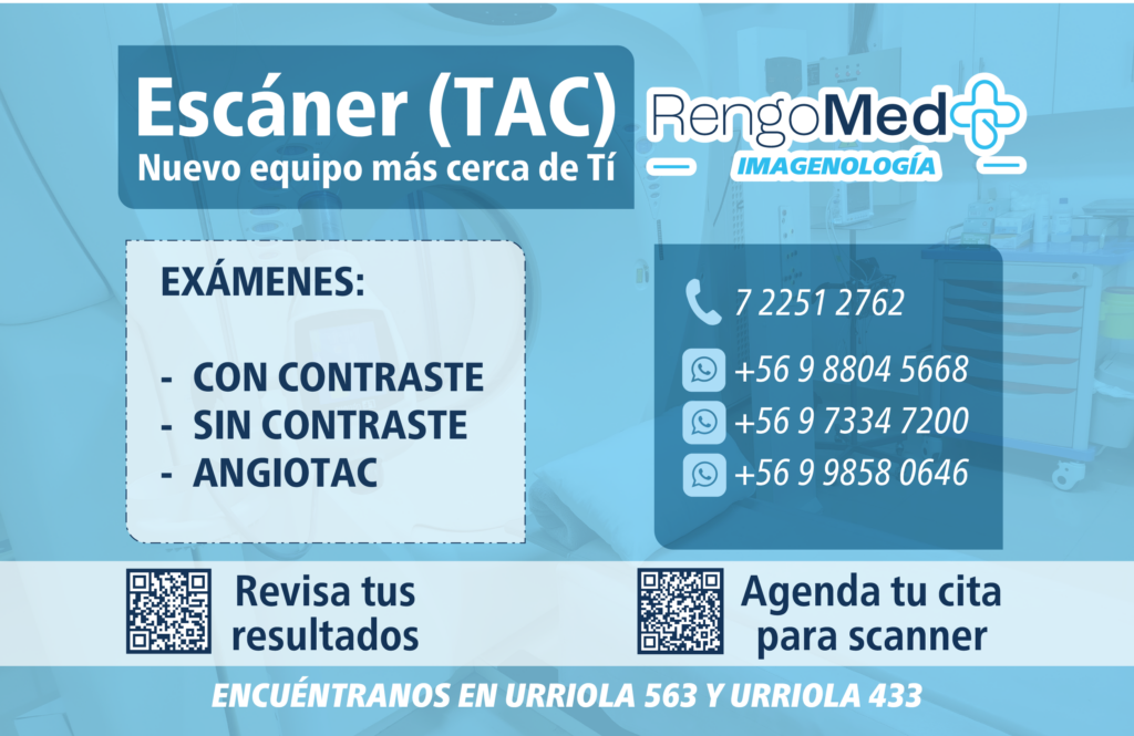Scanner